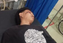 DIDUGA DIANIAYA Di SEKITAR PANTAI CAFE DI JANGKAR OLEH ORANG TAK DIKENAL 4 IMG 20260320 WA0037 1