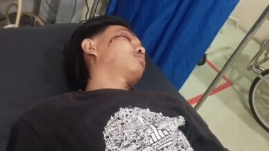 DIDUGA DIANIAYA Di SEKITAR PANTAI CAFE DI JANGKAR OLEH ORANG TAK DIKENAL 2 IMG 20260320 WA0037 1