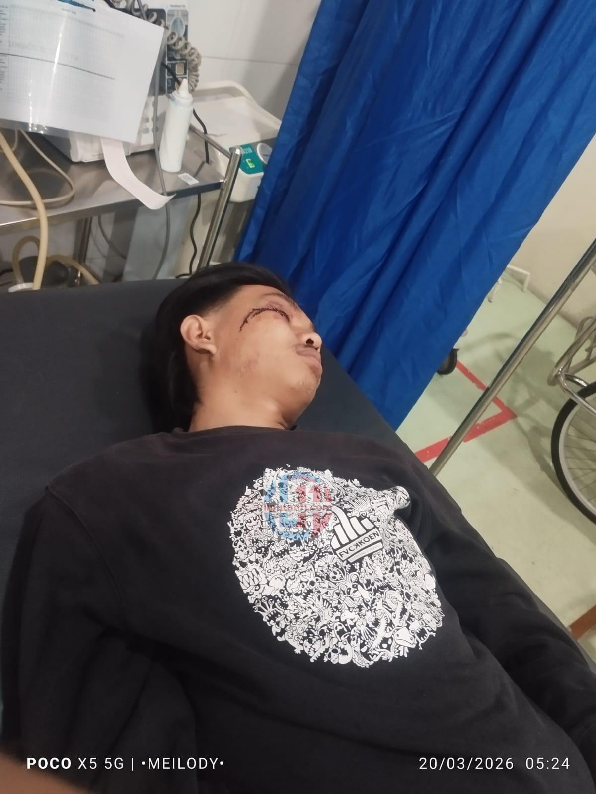 DIDUGA DIANIAYA Di SEKITAR PANTAI CAFE DI JANGKAR OLEH ORANG TAK DIKENAL 1 IMG 20260320 WA0037 1